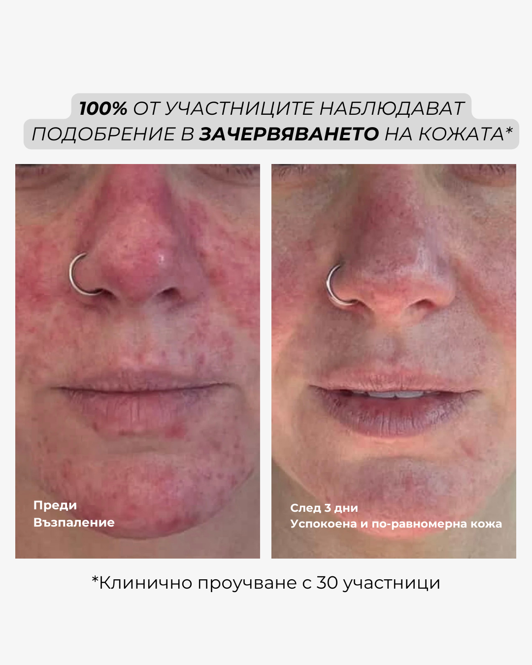reset mist