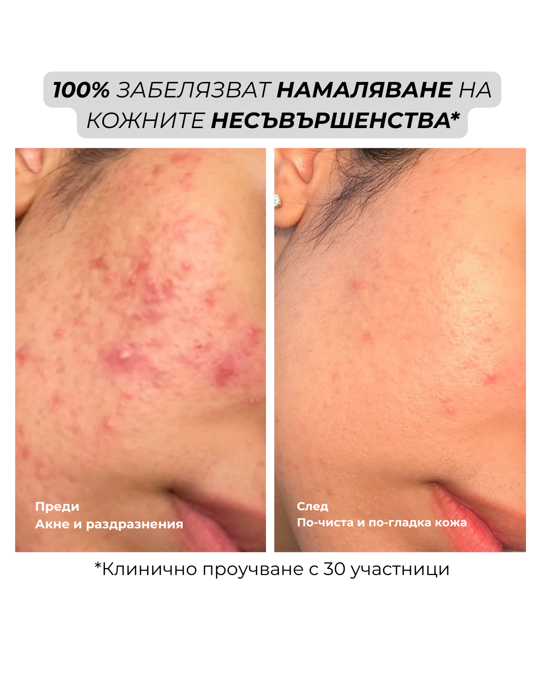 reset mist