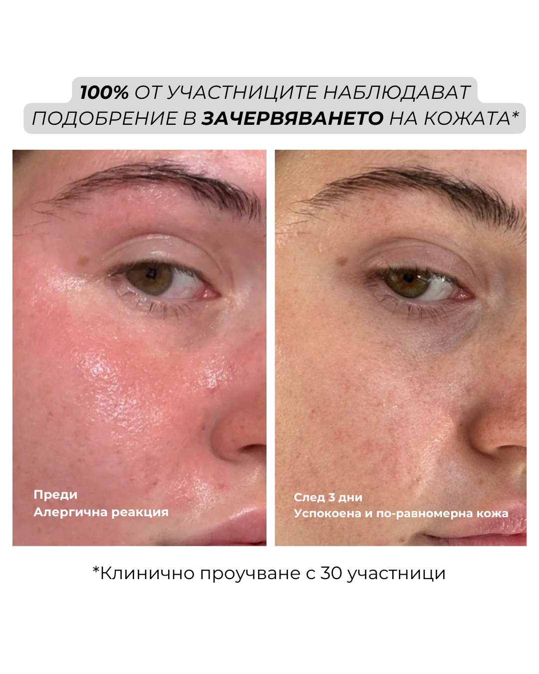 reset mist